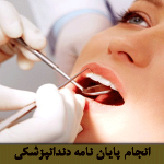 پایان نامه دندانپزشکی
